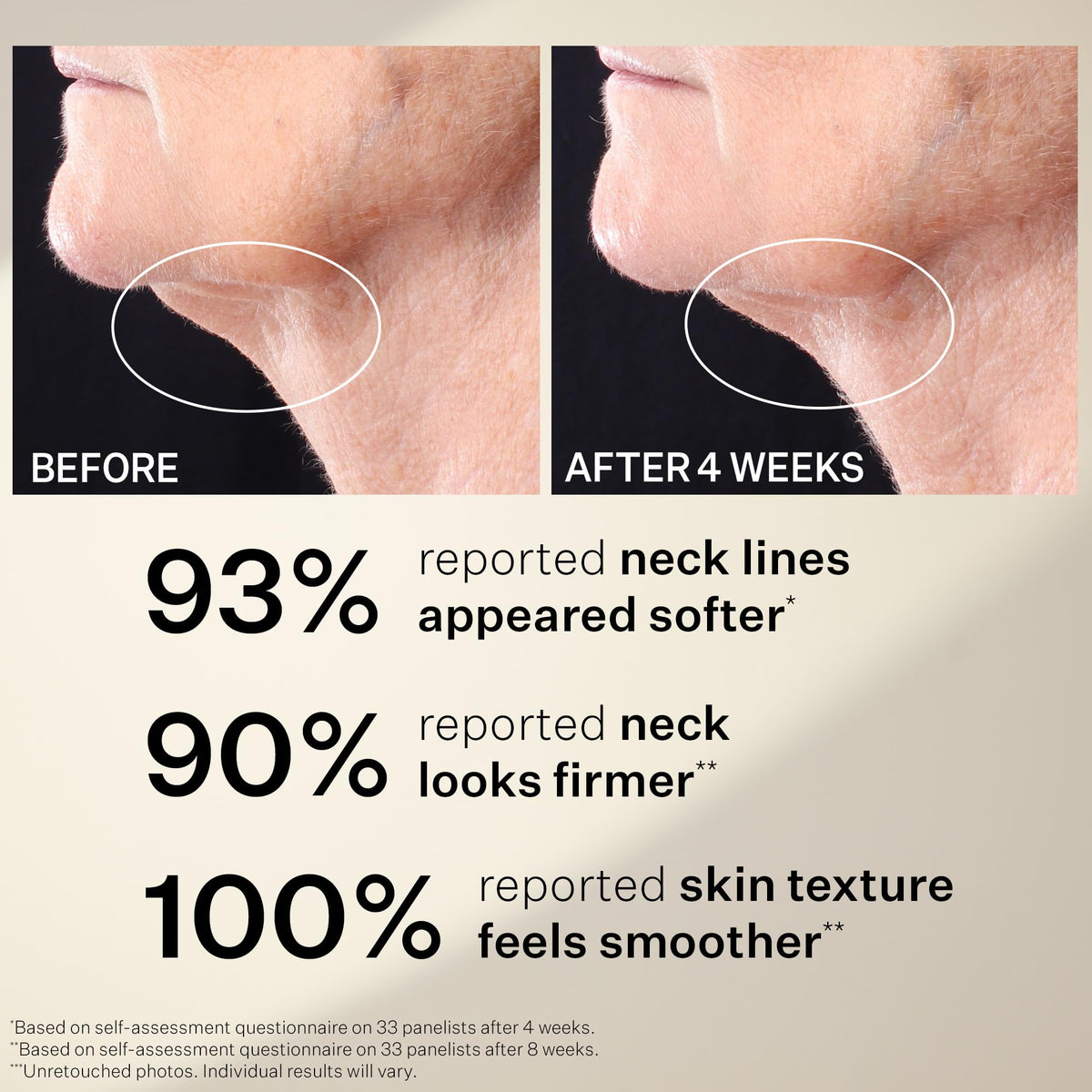 Jawline comparison graphic with StriVectin showing improved contour appearance