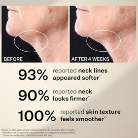 Jawline comparison graphic with StriVectin showing improved contour appearance