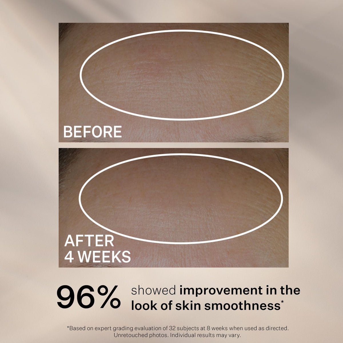 StriVectin application on cheek demonstrating smooth, fast absorption
