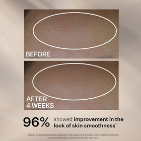 StriVectin application on cheek demonstrating smooth, fast absorption
