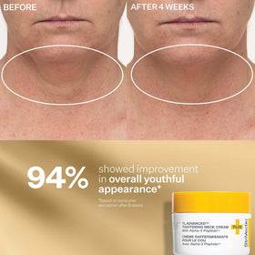 Model applying StriVectin products demonstrating routine and visible tightening benefit