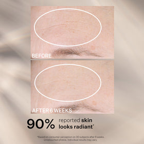 StriVectin label close-up highlighting NIA-114 and ingredient benefit