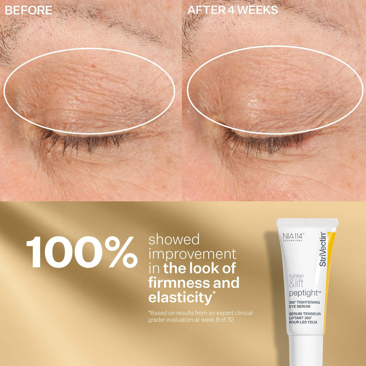 Close-up of StriVectin neck cream texture emphasizing rich hydration benefit