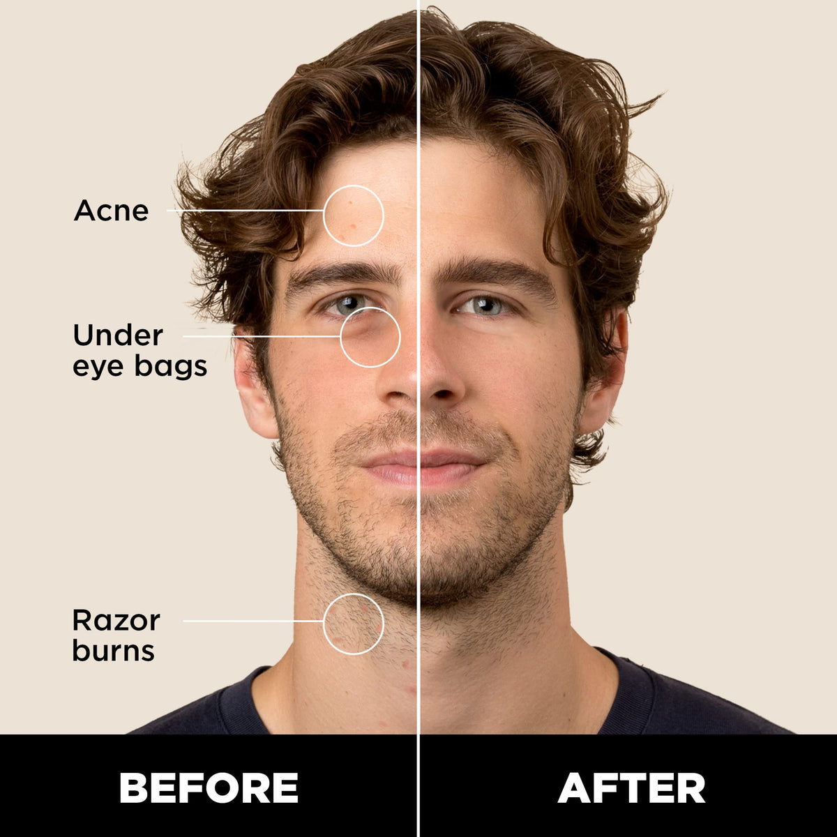 Stryx concealer twist-up mechanism detail for precise controlled dispensing