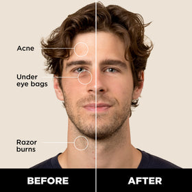 Stryx concealer twist-up mechanism detail for precise controlled dispensing