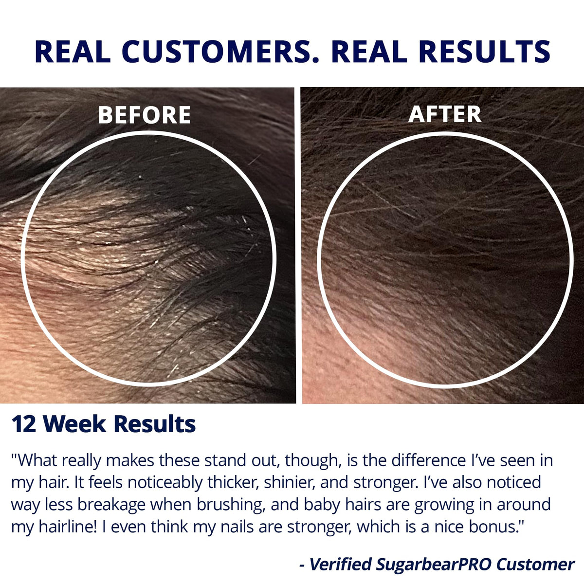SugarBearHair application on scalp demonstration for targeted dropper use and control