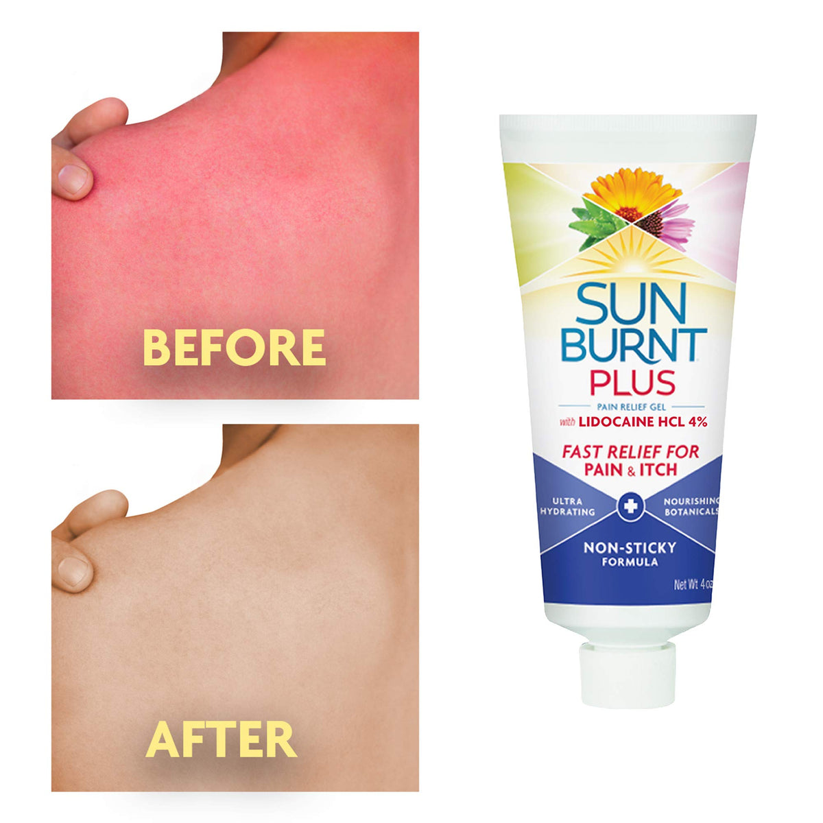 Sunburnt ingredients label highlighting botanicals and lidocaine benefit