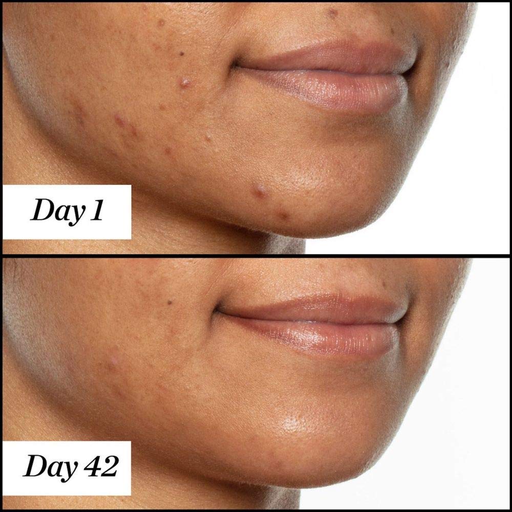 Sunday Riley U.F.O. arranged botanicals showing natural extracts and nourishing benefit