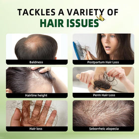 Sunspeak ingredients display with rosemary, mint, biotin for scalp health