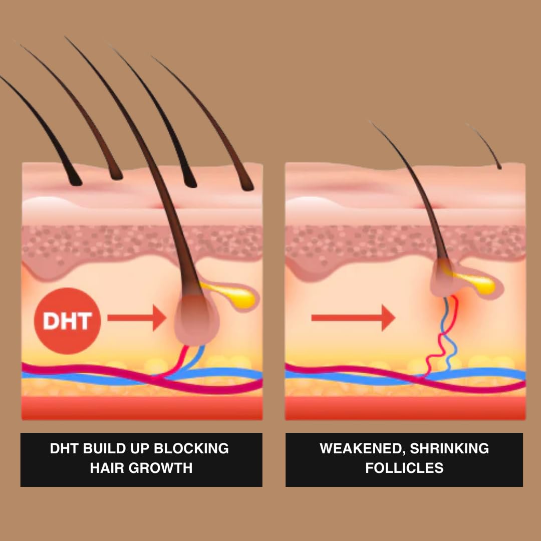 Superior Mane after styling volumized hair showing fuller-looking confidence