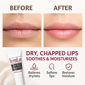 superlan application on lips demonstrating quick soothing relief