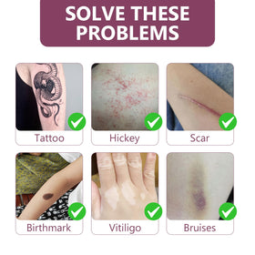 SUPVIN patch on forearm blending with skin tone and providing natural coverage