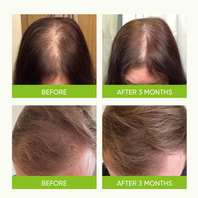 Svvimer scalp application scene highlighting quick absorption and styling