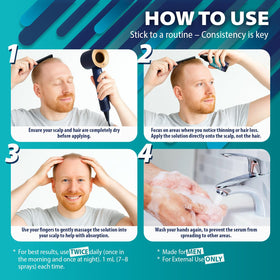 Swiftalyn beard spot treatment depicting targeted facial coverage