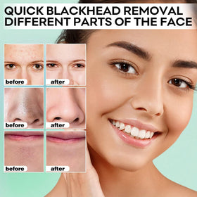 SYABO peel-off action on chin illustrating effective impurity lifting benefit