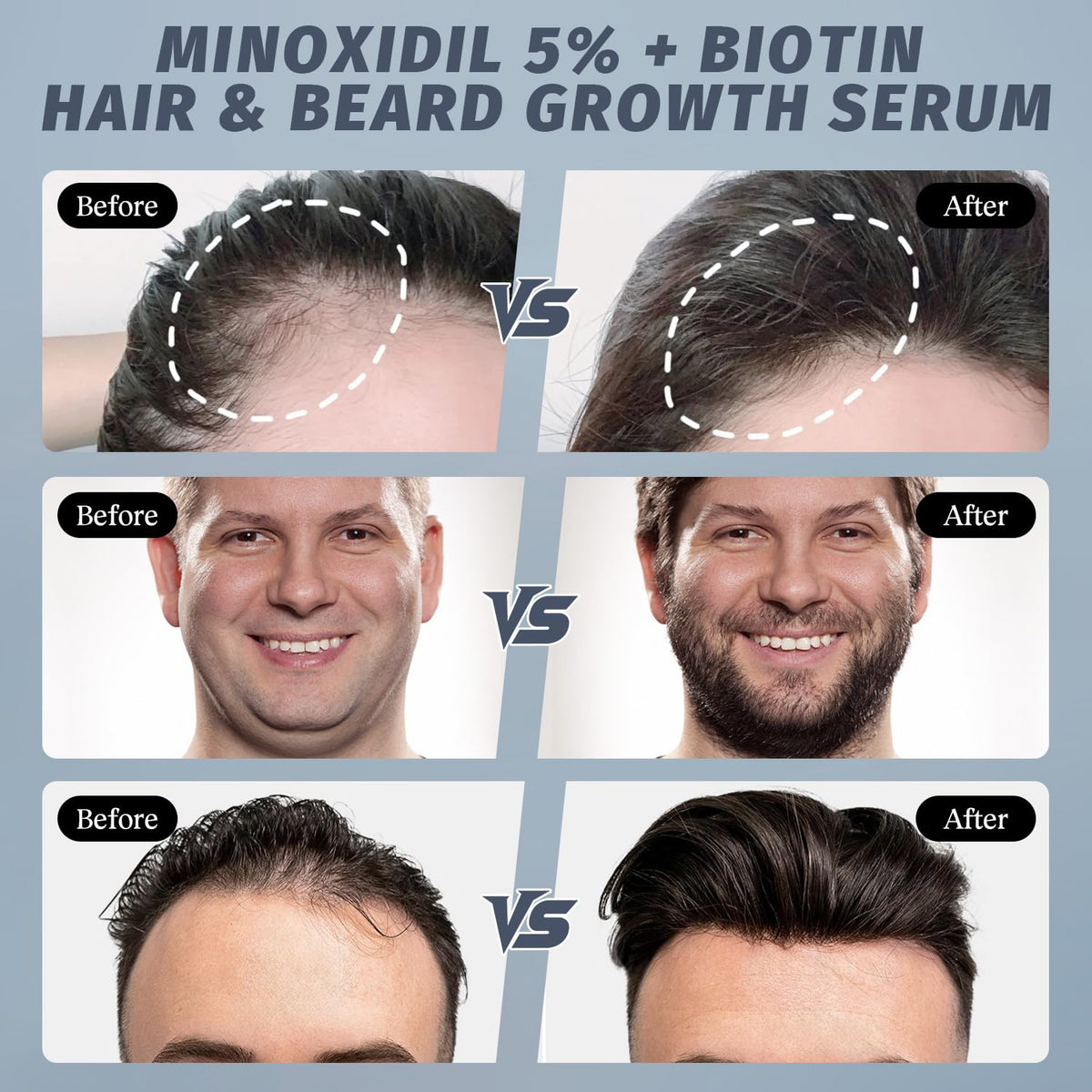 sylvaseren label with rosemary and biotin ingredients showing nourishing benefit