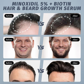 sylvaseren label with rosemary and biotin ingredients showing nourishing benefit