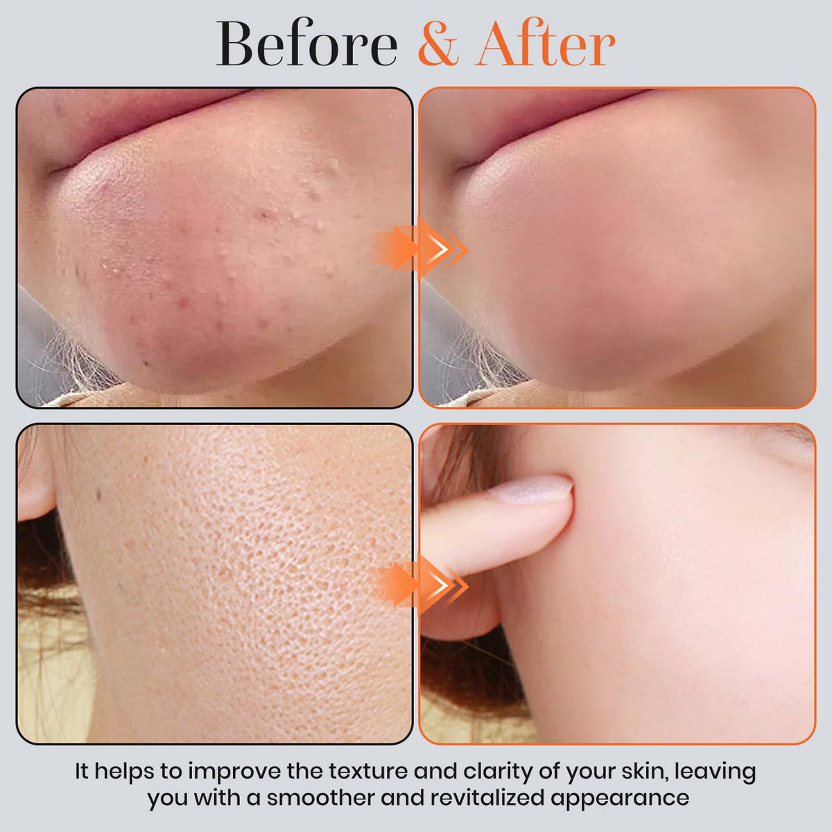 T.Chilyn applied to elbow showing body exfoliation and softer skin result