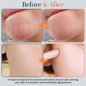 T.Chilyn applied to elbow showing body exfoliation and softer skin result