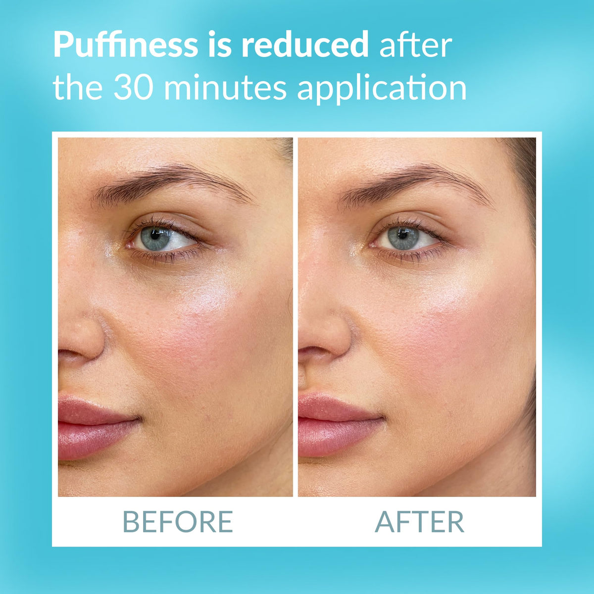 Talika patch applied under eye demonstrating immediate brightening and de-puffing effect
