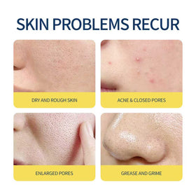 T&K wipe in hand applying to nose demonstrating targeted oil control