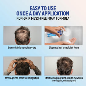 TARO applying foam to scalp showing targeted application and minimal mess
