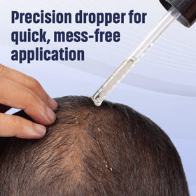 TARO application on scalp showing targeted placement at crown benefit