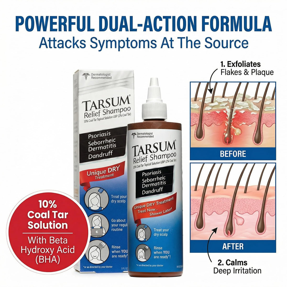 Applying Tarsum to dry scalp demonstrating targeted relief and plaque softening