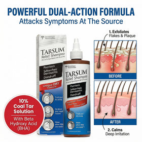 Applying Tarsum to dry scalp demonstrating targeted relief and plaque softening