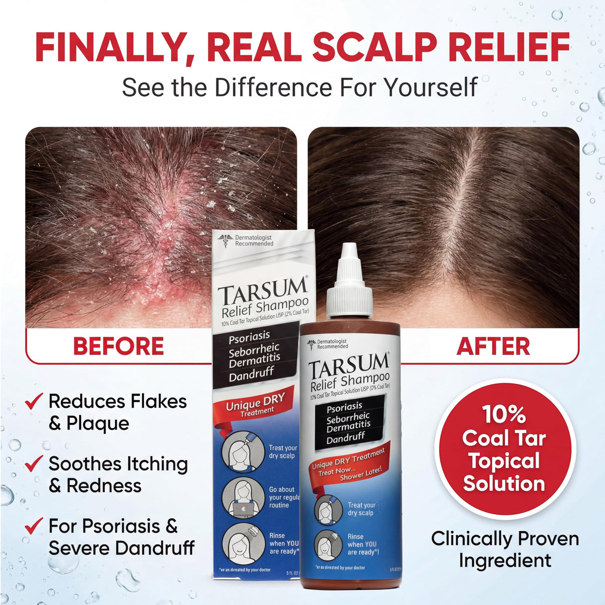 Tarsum gel texture close-up showing smooth consistency for easy scalp application