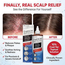 Tarsum gel texture close-up showing smooth consistency for easy scalp application