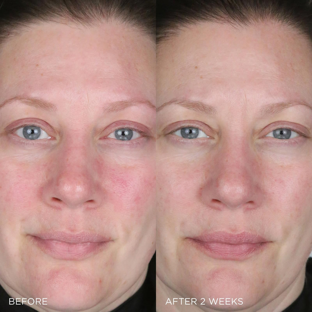 TATCHA applying cream to cheek demonstrating soothing redness relief