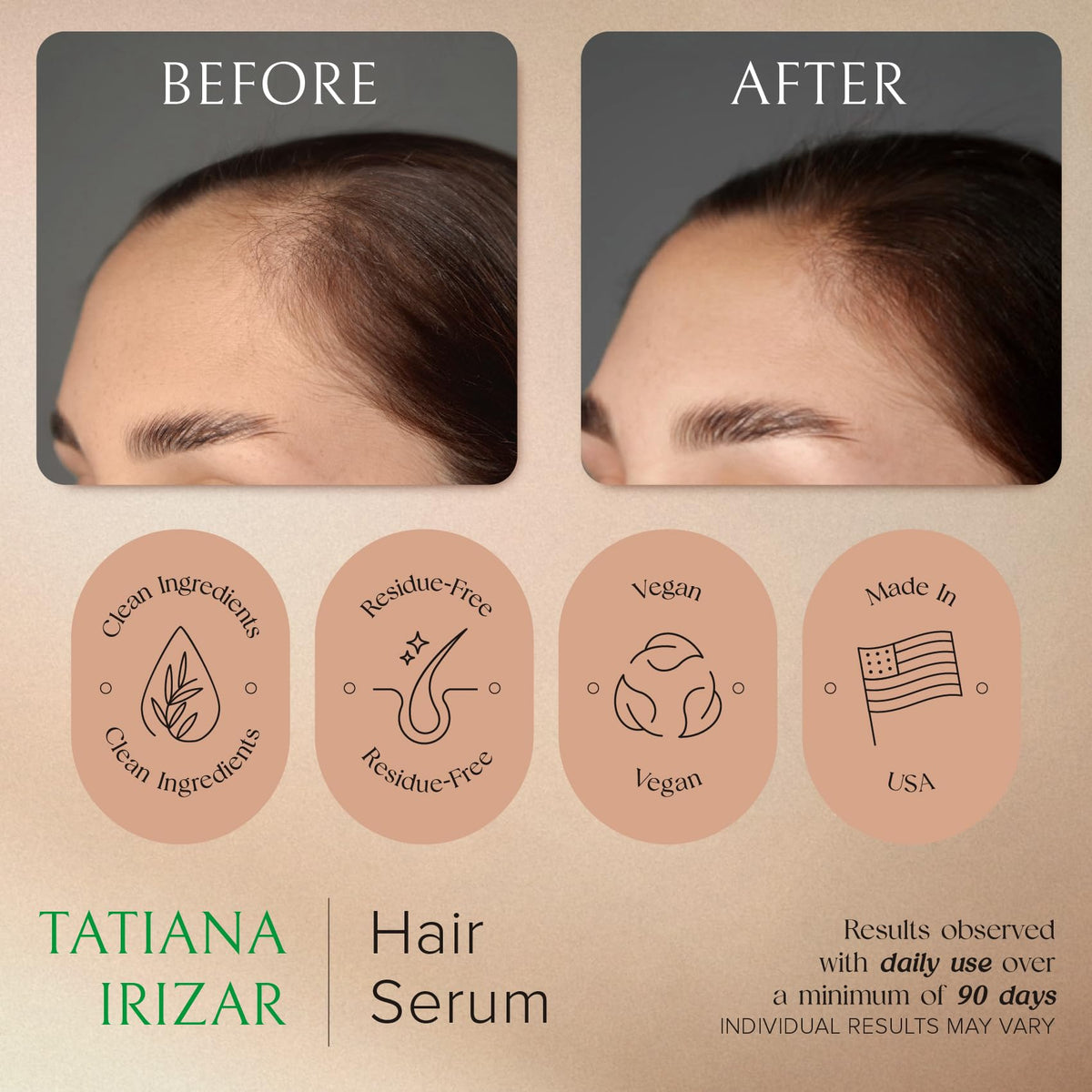 Tatiana Irizar rosemary and amla ingredients visually displayed for natural support