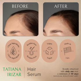 Tatiana Irizar rosemary and amla ingredients visually displayed for natural support