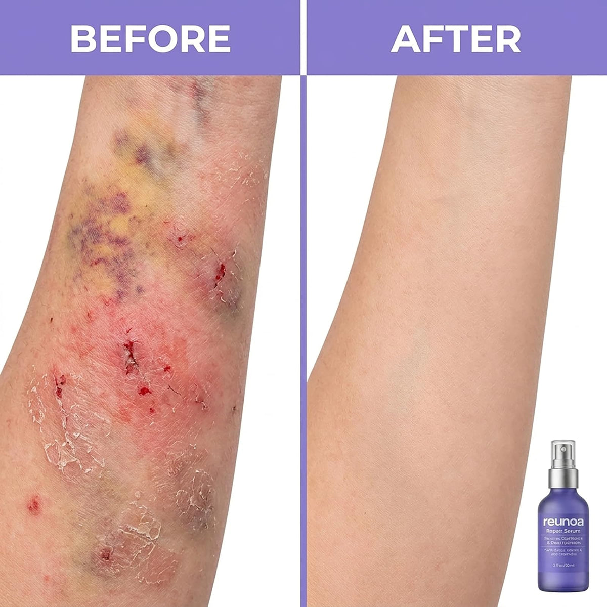 TAWODIUM arnica and vitamin K ingredients grouped to show soothing benefit