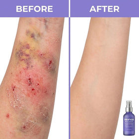 TAWODIUM arnica and vitamin K ingredients grouped to show soothing benefit