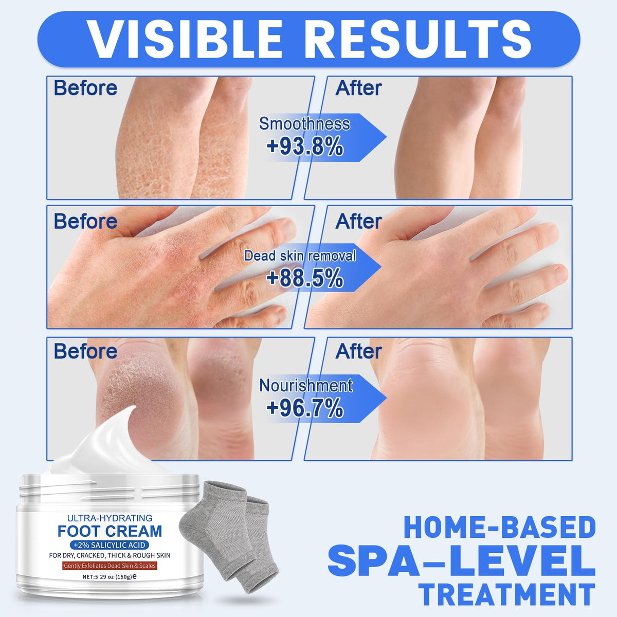 TEAWOO gel heel socks paired with cream for intensified moisturization