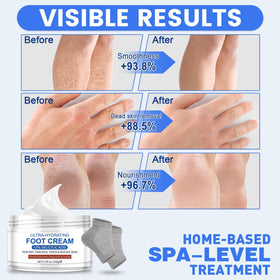 TEAWOO gel heel socks paired with cream for intensified moisturization