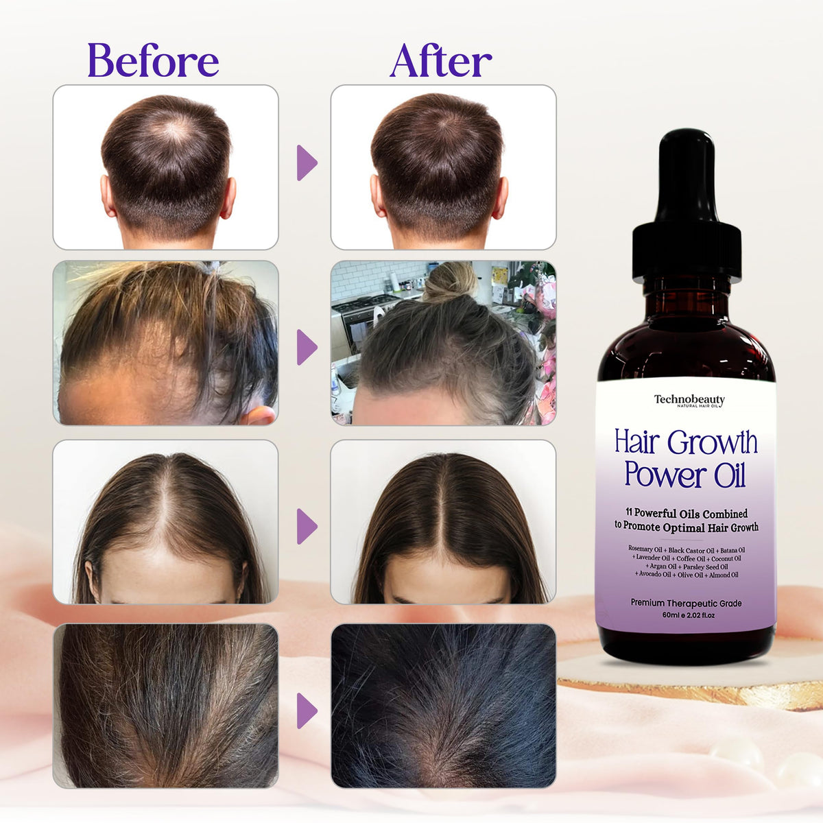 Technobeauty label close-up listing the 11 oils and formulation transparency benefit