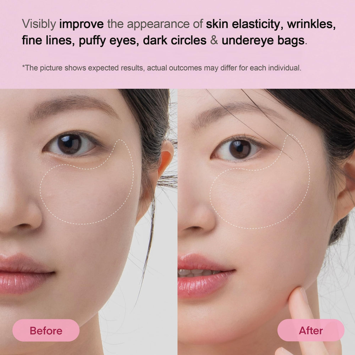 TEREZ & HONOR patch applied under eye in mirror, visibly cooling and soothing benefit: instant refresh