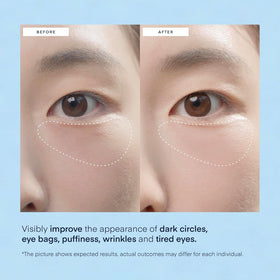TEREZ & HONOR patch in place under model eye demonstrating comfortable, secure fit