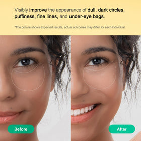 TEREZ & HONOR small patch on smile line delivering targeted smoothing