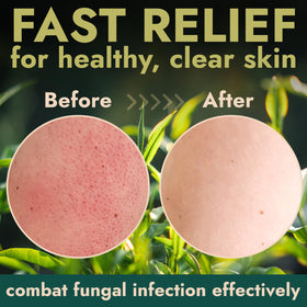 Terramed Just Think Comfort in-shower application demonstrating effective exfoliation