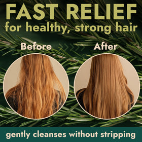 Terramed Just Think Comfort silicone scalp brush held in hand to boost gentle circulation and product spread