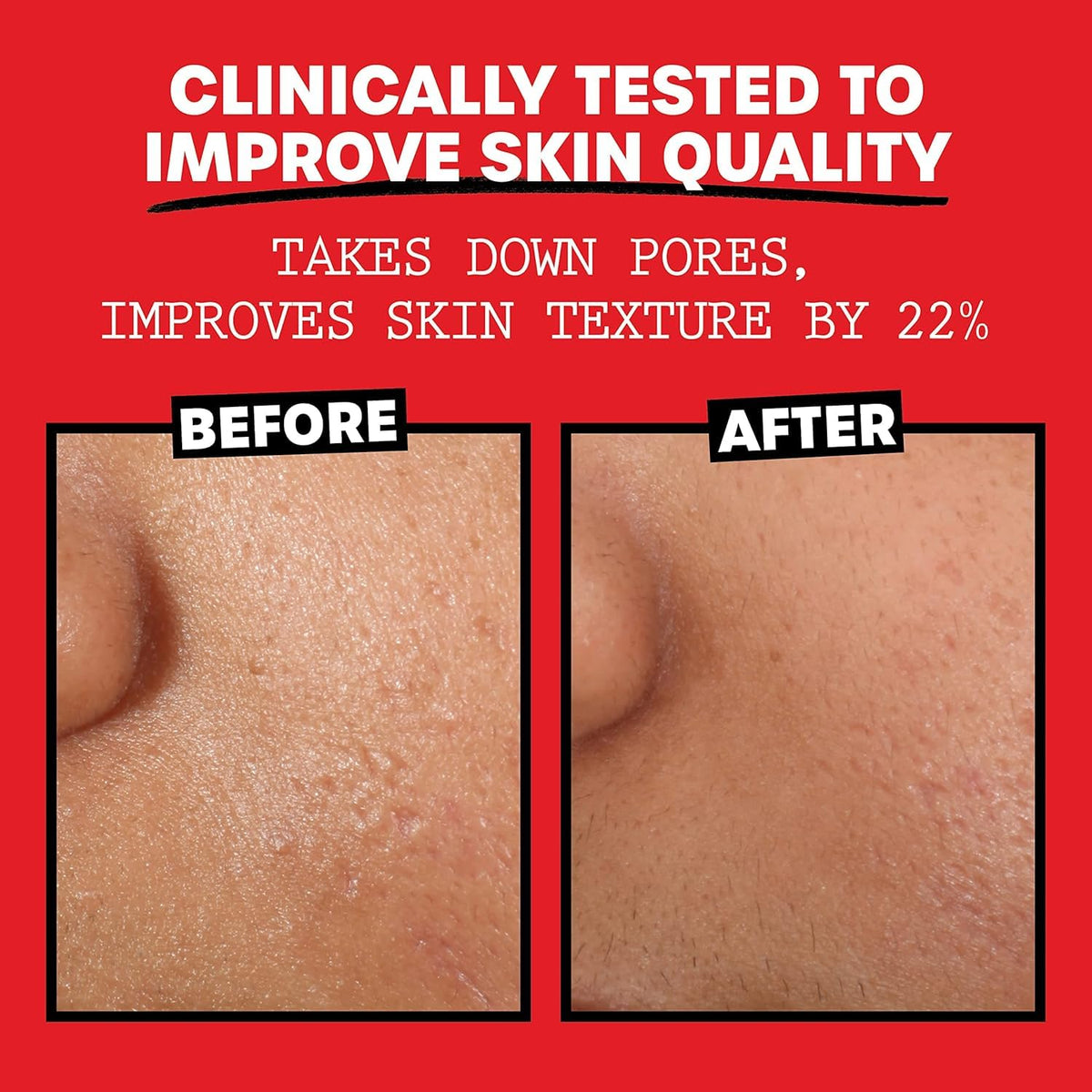 THAYERS label detail highlighting organic aloe and witch hazel
