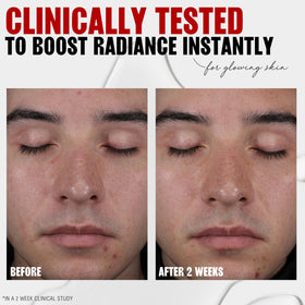 Thayers liquid texture on skin demonstrating gentle AHA absorption and smoothing