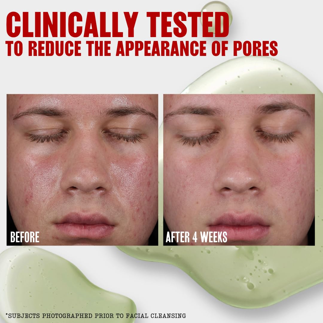 THAYERS toner on cotton pad sweeping face for gentle oil control benefit