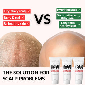 the bald brothers application on scalp demonstrating smooth coverage and easy spreadability