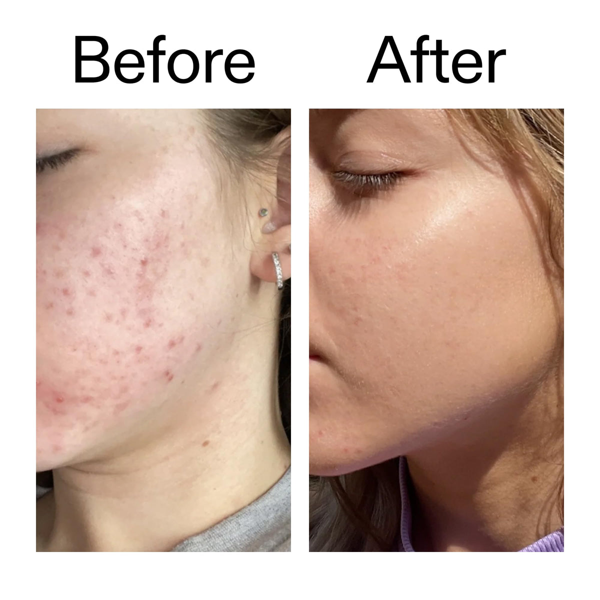 The INKEY List application on face showing thin layer for everyday layering