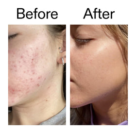 The INKEY List application on face showing thin layer for everyday layering